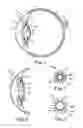 Fig. 02 - Haptic for accommodating intraocular lens