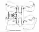 Fig. 01 - Advanced intra-spinal decompression implant