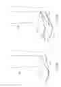 Fig. 06 - Spine surgery device