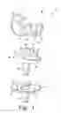Fig. 02 - Posterior stabilized orthopaedic knee prosthesis having controlled condylar curvature