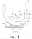 Fig. 03 - Posterior stabilized orthopaedic knee prosthesis having controlled condylar curvature