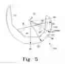 Fig. 06 - Posterior stabilized orthopaedic knee prosthesis having controlled condylar curvature