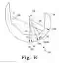 Fig. 07 - Posterior stabilized orthopaedic knee prosthesis having controlled condylar curvature