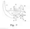 Fig. 08 - Posterior stabilized orthopaedic knee prosthesis having controlled condylar curvature