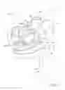 Fig. 02 - Knee joint prosthesis system and method for implantation