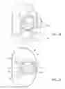 Fig. 08 - Knee joint prosthesis system and method for implantation