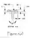 Fig. 06 - Joint resurfacing prosthetic implant system