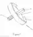 Fig. 09 - Joint resurfacing prosthetic implant system