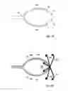 Fig. 04 - Rope having a spliced eye, corresponding method of forming an eye and use of the rope
