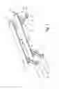Fig. 02 - Method for producing a track and track for a track lifting device