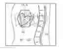 Fig. 01 - Artifact suppression in multi-coil MRI