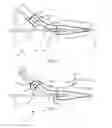 Fig. 03 - Method and device for optically coupling optical fibres