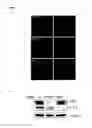 Fig. 02 - Methods for Modulation of Autophagy Through the Modulation of Autophagy-Enhancing Gene Products