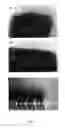 Fig. 02 - Compositions for Induction of Osteogenesis around an Implant