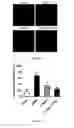 Fig. 07 - Methods for preventing oxidative stress injury of a tissue by a Folate-TEMPOL conjugate
