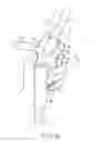 Fig. 18 - ENDOSCOPE