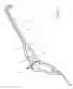 Fig. 02 - COVER FOR A LAPAROSCOPE, SYSTEMS INCLUDING THE COVER AND METHODS OF USE