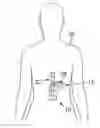 Fig. 01 - Medical Procedure Localizing Aid
