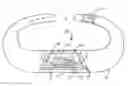Fig. 01 - Integrated wireless non-invasive perfusion sensor and method of use