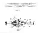 Fig. 06 - Catheter mounted automatic vessel occlusion and fluid dispersion devices