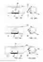 Fig. 08 - Catheter mounted automatic vessel occlusion and fluid dispersion devices