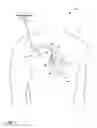Fig. 02 - Acoustic based cough detection