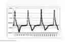 Fig. 08 - Apparatus And Method For Diagnosis Of Individual Characteristics Based On Oscillometric Arterial Blood Pressure Measurement