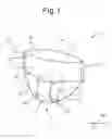 Fig. 02 - Absorbent article
