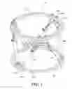 Fig. 02 - Orthopedic external fixation device