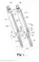Fig. 02 - PERCUTANEOUS ROD DELIVERY TECHNIQUES AND SYSTEMS