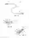 Fig. 02 - APPARATUS AND METHODS FOR POSITIONING AND SECURING ANCHORS