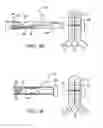 Fig. 06 - APPARATUS AND METHODS FOR POSITIONING AND SECURING ANCHORS