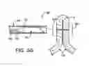 Fig. 07 - APPARATUS AND METHODS FOR POSITIONING AND SECURING ANCHORS