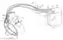 Fig. 01 - METHODS AND APAPRATUS FOR MANUALLY SUSPENDING INTRATHORACIC IMPEDANCE FLUID STATUS MEASUREMENTS
