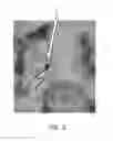 Fig. 06 - Method and system for determining settings for deep brain stimulation