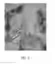 Fig. 07 - Method and system for determining settings for deep brain stimulation