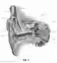Fig. 02 - Progressive parameter scan for cochlear implants