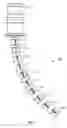 Fig. 02 - Bend limiting stiffener and related methods