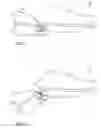 Fig. 02 - Closure systems for articles of footwear