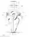 Fig. 15 - Universal container capper/decapper