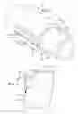 Fig. 02 - Split fitting for pipe