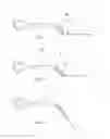 Fig. 02 - Articulating eyeglass retainer system