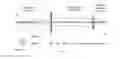 Fig. 02 - Compact wavefront sensor module and its attachment to or integration with an ophthalmic instrument