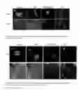 Fig. 03 - Materials Composition and Methods to Control Neural Progenitor and Stem Cell Attachment, Proliferation and Guide Cell Differentiation