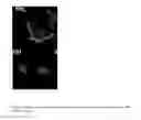 Fig. 07 - Materials Composition and Methods to Control Neural Progenitor and Stem Cell Attachment, Proliferation and Guide Cell Differentiation