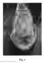 Fig. 02 - Pharmaceutical Composition Containing Expanded Adult Stem Cells and Methods of Using Same for Treatment
