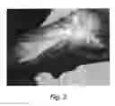 Fig. 04 - Pharmaceutical Composition Containing Expanded Adult Stem Cells and Methods of Using Same for Treatment