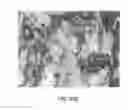 Fig. 22 - Methods of using adipose tissue-derived cells in augmenting autologous fat transfer
