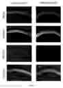 Fig. 31 - VEGF-D/VEGFR2/3-MEDIATED REGULATION OF DENDRITES