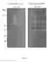 Fig. 02 - Compositions and methods for enhancing coagulation Factor VIII function